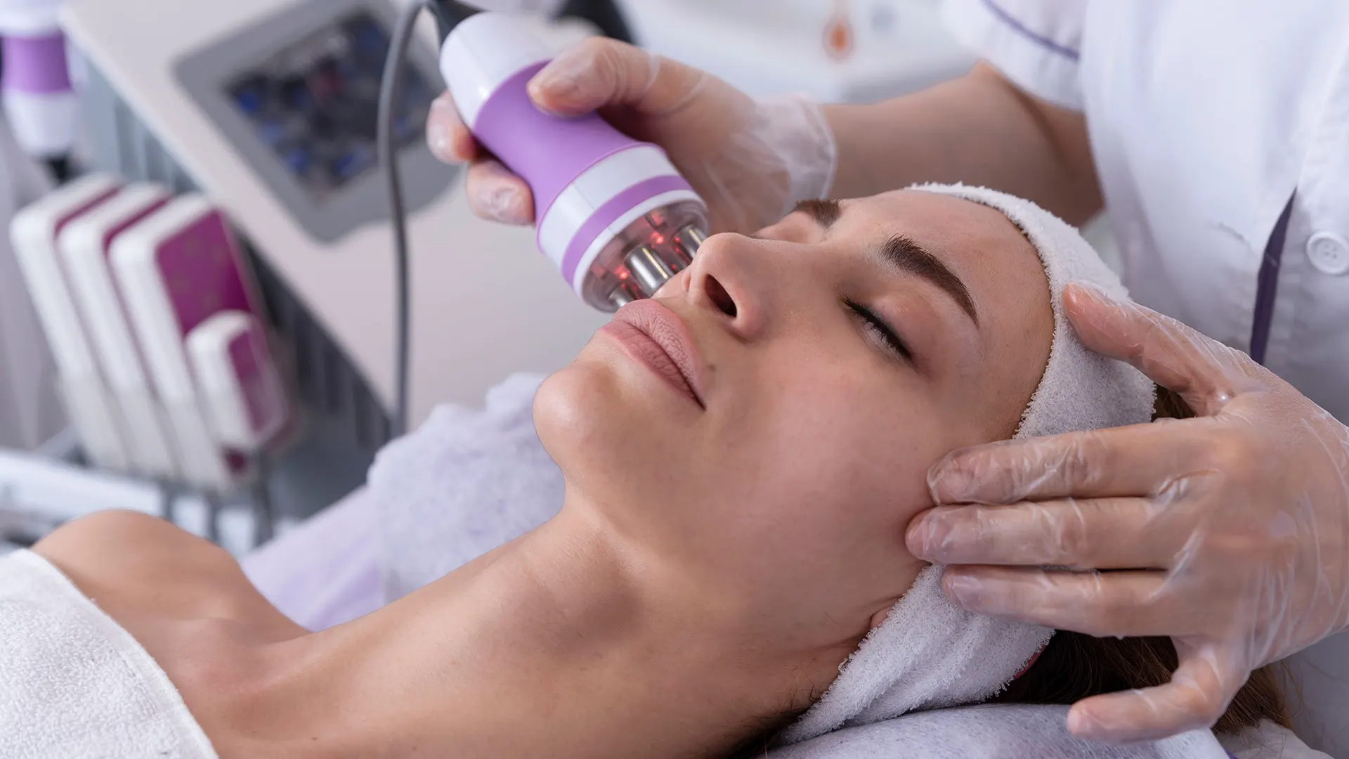 Radiofrecuencia Fraccionada Facial