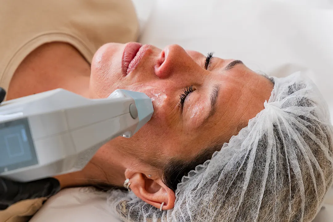 mujer recibiendo tratamiento de radiofrecuencia ultra 360 rejuvenecimiento